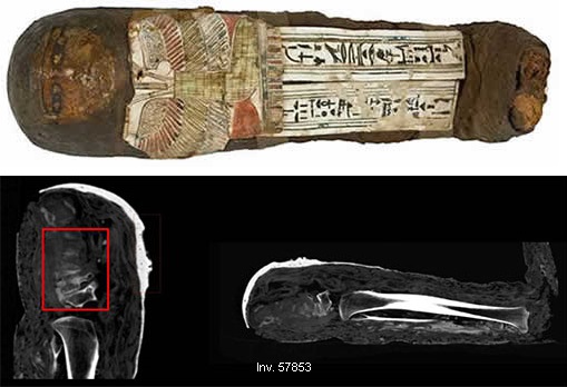 Due false mummie ai Musei Vaticani - Djed Medu