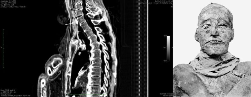 Cold Case: Ramesse III è stato sgozzato (e forse abbiamo il colpevole) - Djed Medu