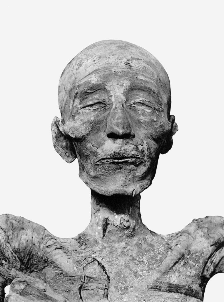 Spondilite anchilosante o DISH? Diagnosi sulle mummie reali - Djed Medu